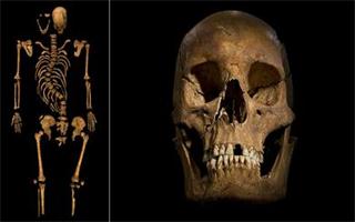 莱切斯特大学3D扫描揭露理查德三世脊柱真相