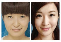 乔丽 韩式无痕媚眼术