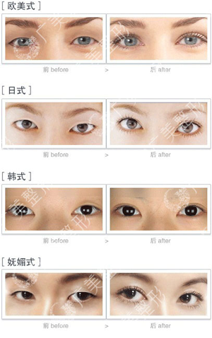 ����������Ȼ�޺�PERK˫��Ƥ