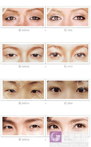 ����������Ȼ�޺�PERK˫��Ƥ